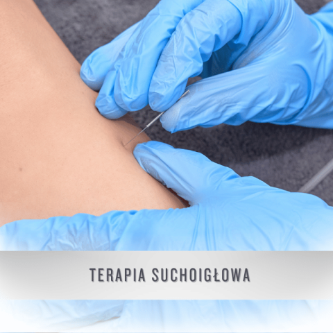 terapia suchoigłowa